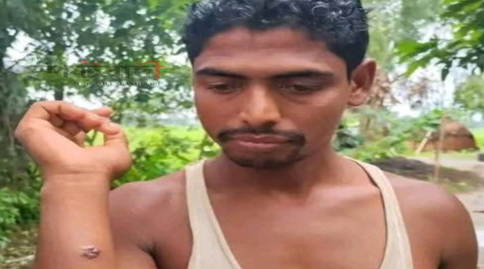 গাইবান্ধায় এক গ্রামেই ১১ ব্যক্তির শরীরে অ্যানথ্রাক্সের উপসর্গ
