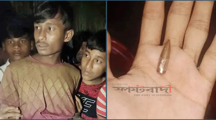 টেকনাফ সীমান্তের ওপারে গোলাগুলি, এপারে গুলিবিদ্ধ রোহিঙ্গা যুবক