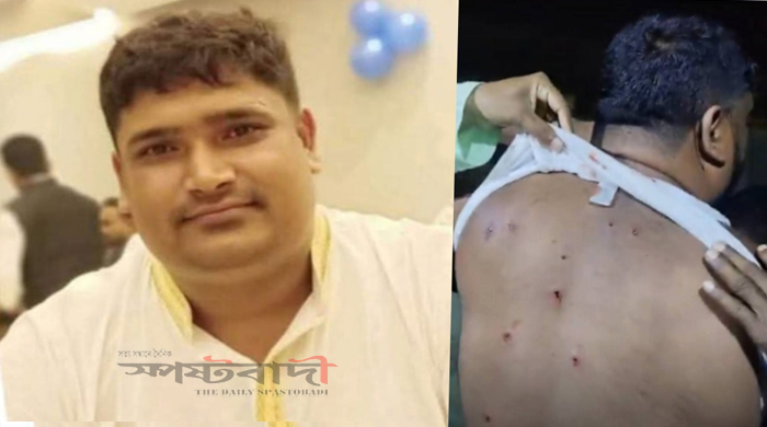কক্সবাজারে বিএনপি নেতাকে গুলি করে গুরুতর আহত করেছে দুর্বৃত্তরা